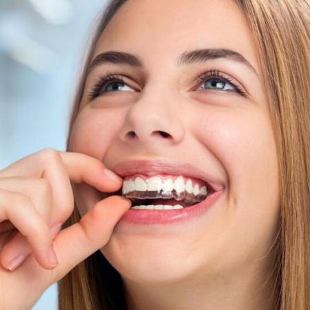 Aligners