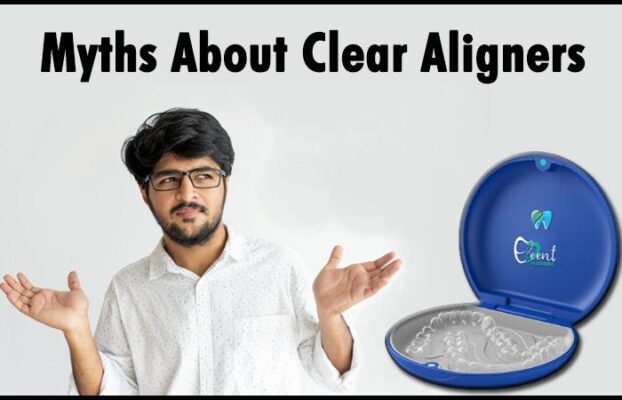 Common Misconceptions About Clear Aligners