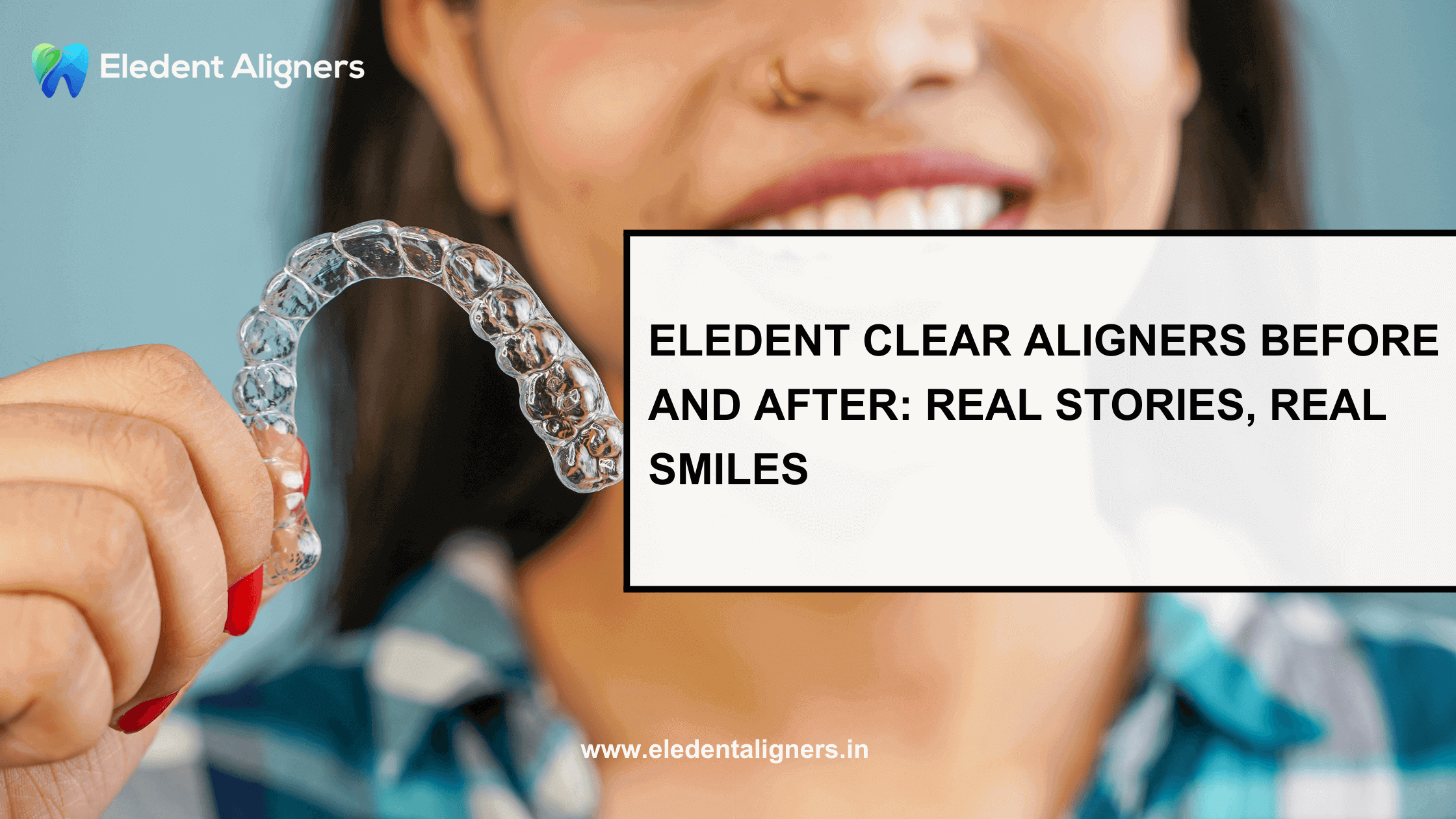 Eledent Clear Aligners Before and After: Real Stories, Real Smiles