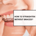 How to Straighten Teeth Without Braces