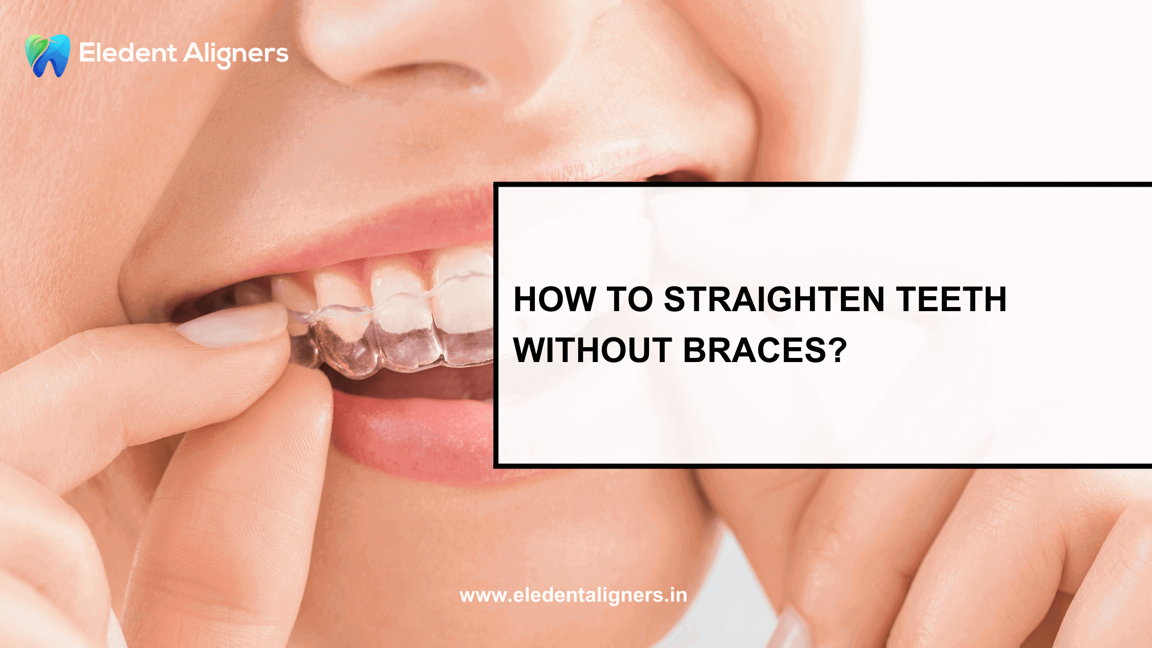 How to Straighten Teeth Without Braces?