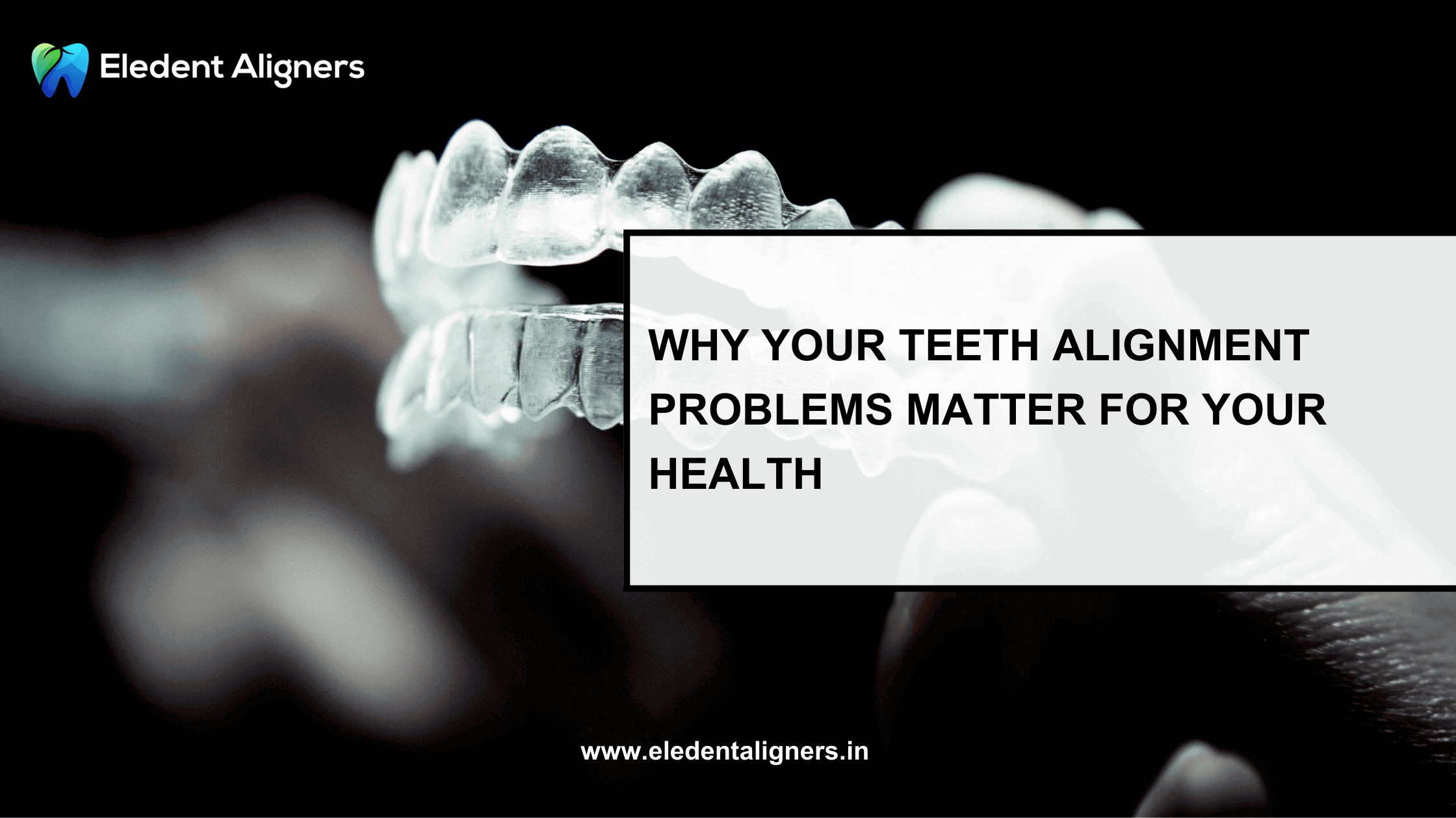 Beyond Aesthetics: Why Your Teeth Alignment Problems Matter for Your Health