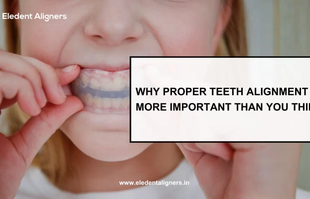 Why Proper Teeth Alignment is More Important than You Think