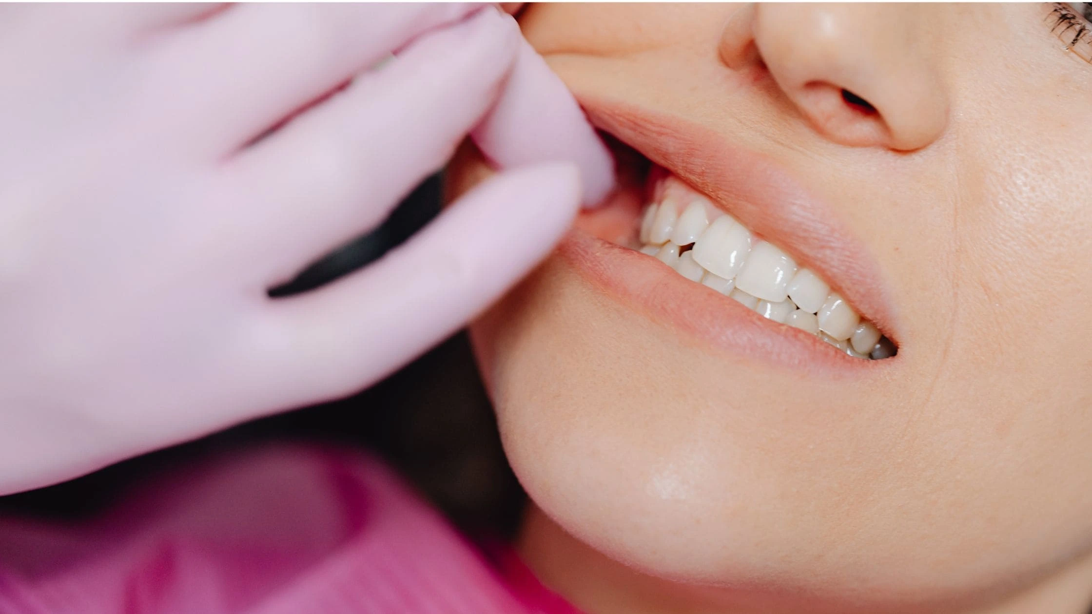 what is Teeth Alignment